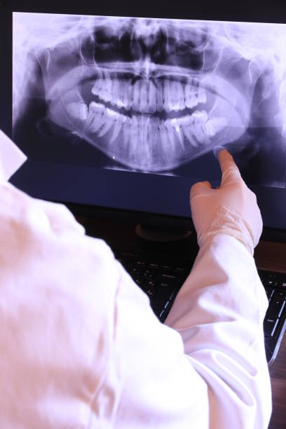 Best Emergency Root Canal Treatment in Chester, CA