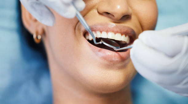 Best Emergency Treatment for Dental Infections or Abscesses in Chester, CA